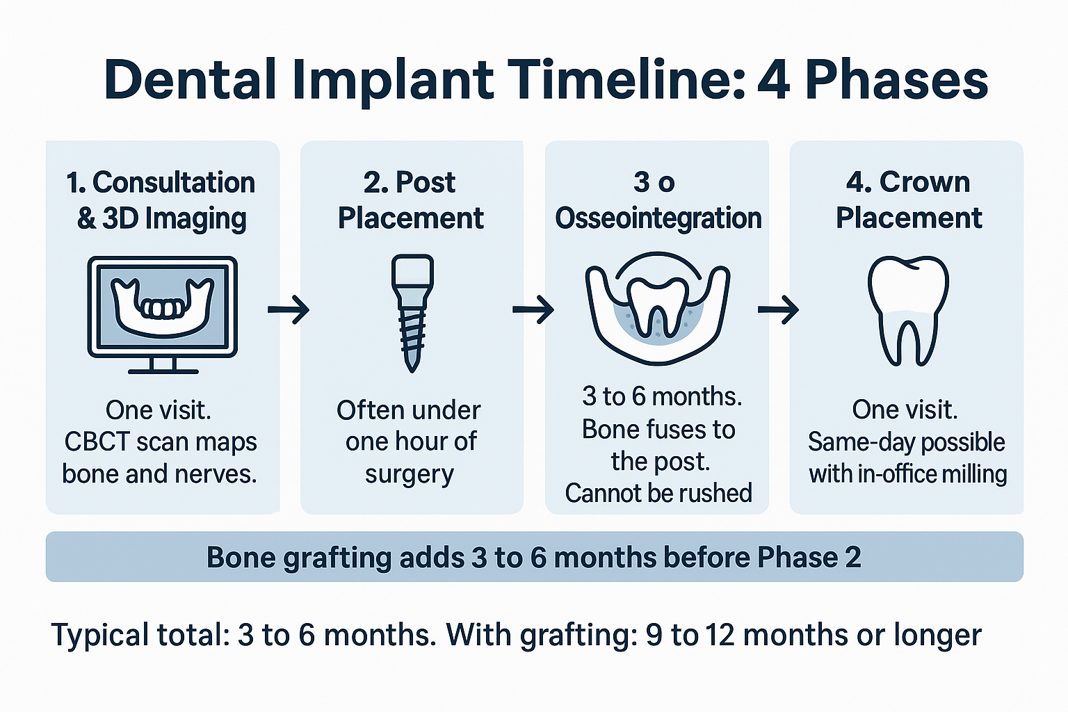 Infographic showing the four phases of the dental implant timeline and how bone grafting extends it